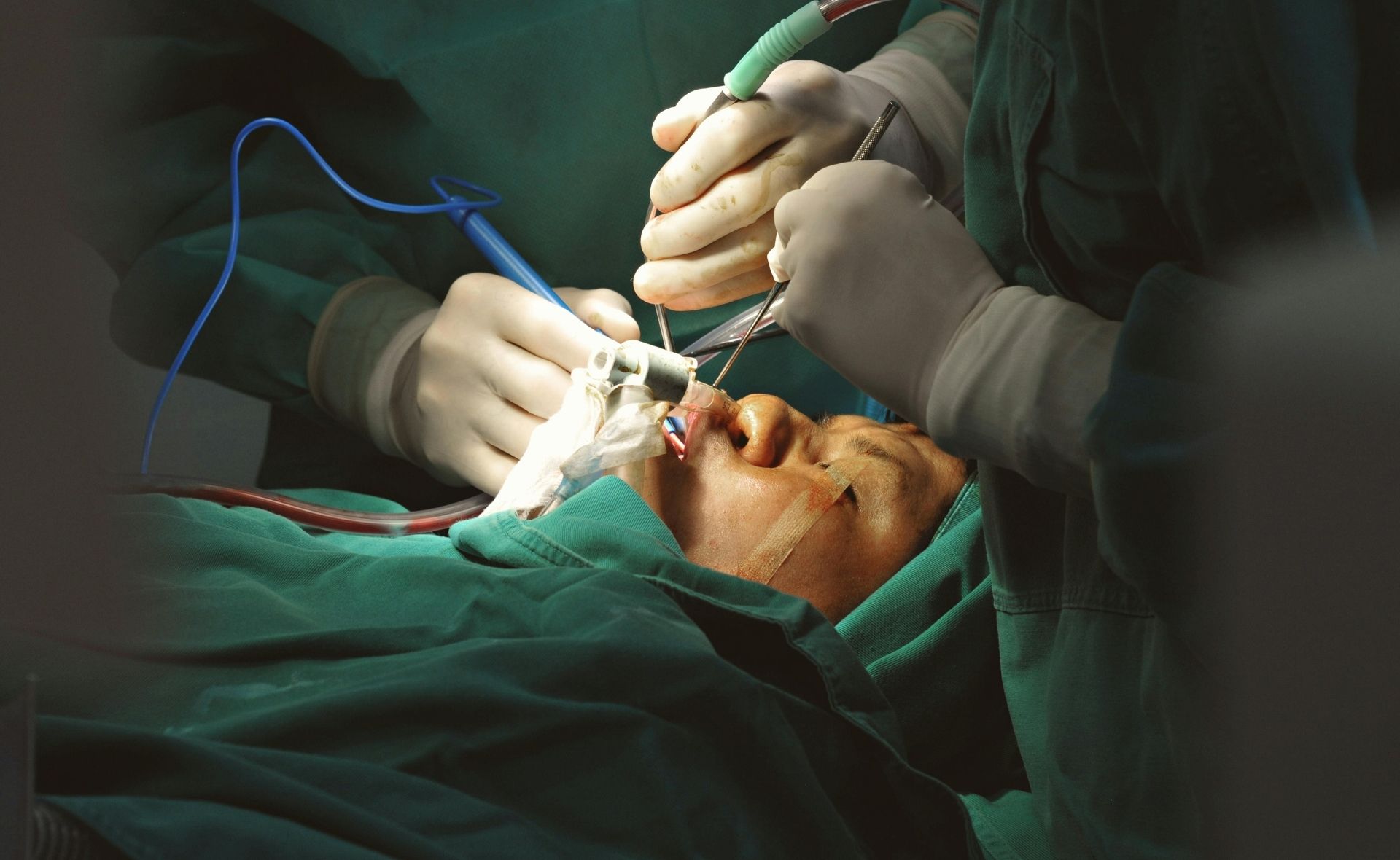 Laser Surgery & Sclerotherapy